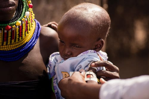 Extremely malnourished two-and-a-half-year-old boy in Natoo Village measures at the size and development of a seven-month old baby.